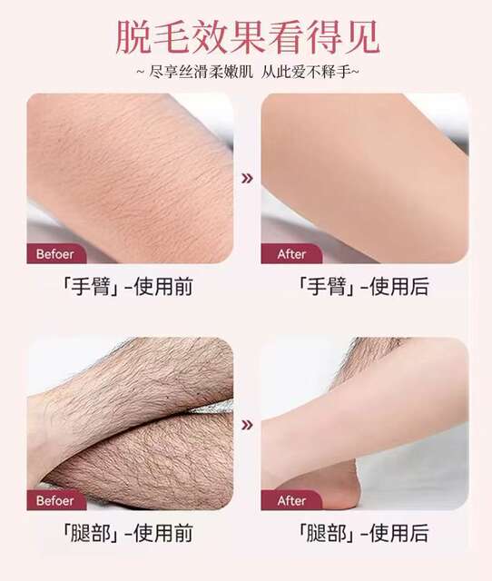 Disposable Thickened and Hardened Non-Woven Fabric Hair Removal Paper, Beauty and Body Hair Removal Cloth, Beeswax Auxiliary Tools Wholesale detail 12