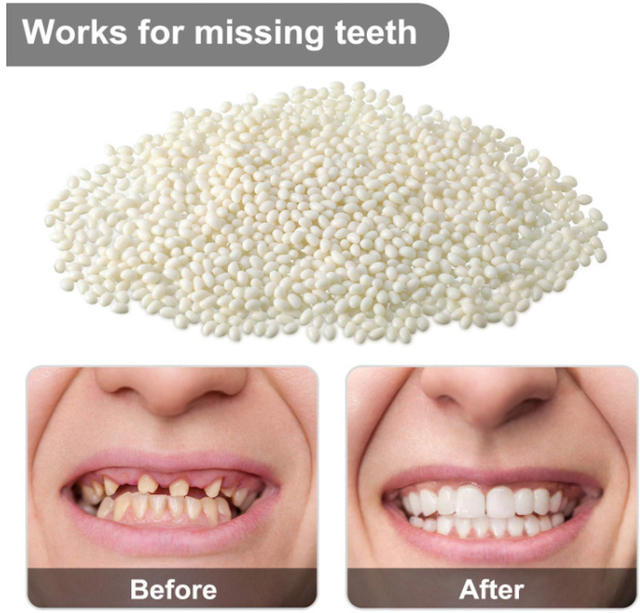Cross-Border Export Oral Care Kit Denture Resin Teeth Missing Teeth Front Teeth Gaps Tooth Holes Braces Material Glue detail 3