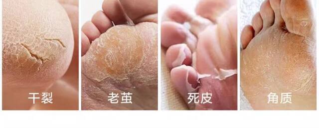 [Shake sound explosions] remove dead skin calluses household heel stone foot stone foot grinding device foot rubbing plate double-sided detail 9