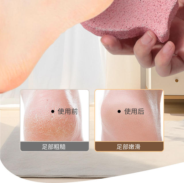 Lamela Volcanic Stone Double-Sided Foot Grinding Stone Exfoliating Tool Heel Pedicure Foot Grinder C0374 detail 10