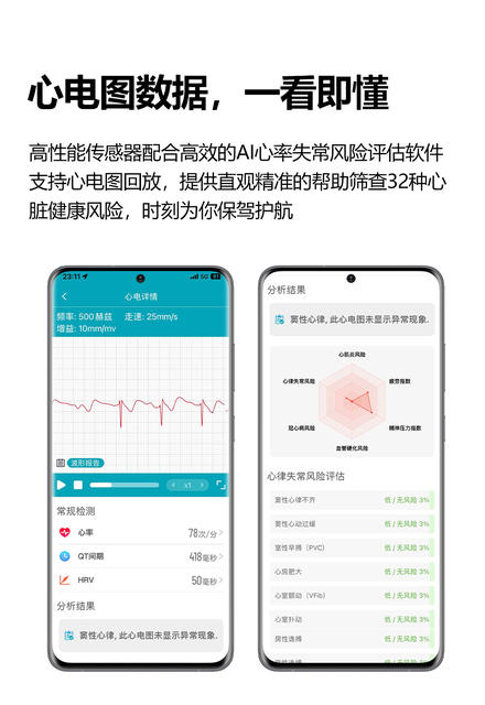 Et588(Hband) Blood Oxygen Ecg Ecg Sos Micro-Health Check Nfc Bluetooth Calling Ai Voice Smart Watch detail 11