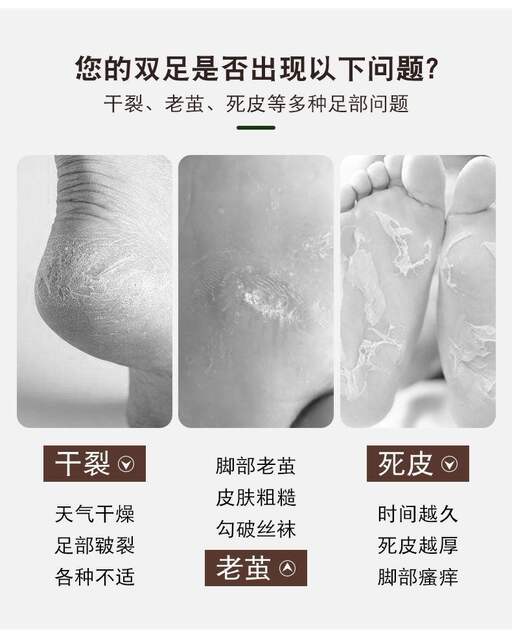 Remove horny calluses foot stone pure natural volcanic stone exfoliating skin sole heel pedicure artifact rain flower stone detail 3