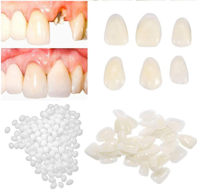 Cross-Border Export Oral Care Kit Denture Resin Teeth Missing Teeth Front Teeth Gaps Tooth Holes Braces Material Glue detail 5