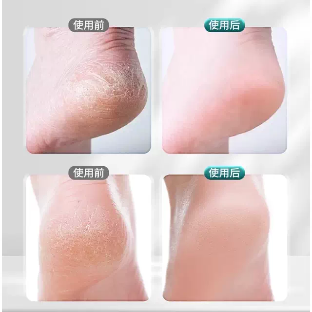 Nano Glass Foot Scrubber for Women, Exfoliating Tool for Removing Dead Skin, Foot Care Scraper for Heels and Foot Skin, Foot Grinding Stone detail 5