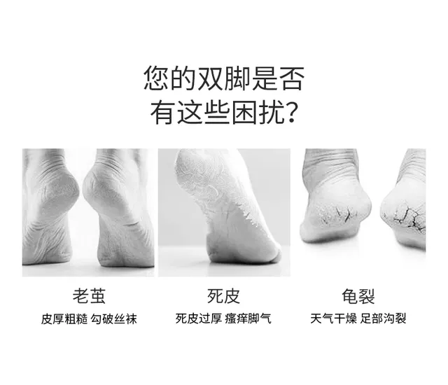 Pedicure Artifact to remove dead skin calluses household heel scraping sole foot grinding stone knife foot skin grinding device foot rubbing board detail 1