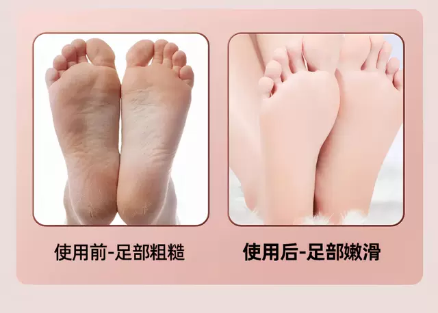 Nano Glass Foot Scrubber for Women, Exfoliating Tool for Removing Dead Skin, Foot Care Scraper for Heels and Foot Skin, Foot Grinding Stone detail 10