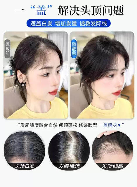 Cloud Light Gauze Hairpiece for Women, Real Hair to Increase Hair Volume, Seamless Forehead Cover for Gray Hair, Lightweight and Breathable Hair Patch detail 3